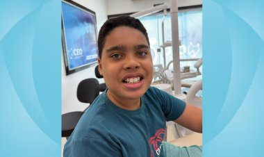 Saúde de Floriano amplia acesso à ortodontia com entrega gratuita de aparelho Bionator